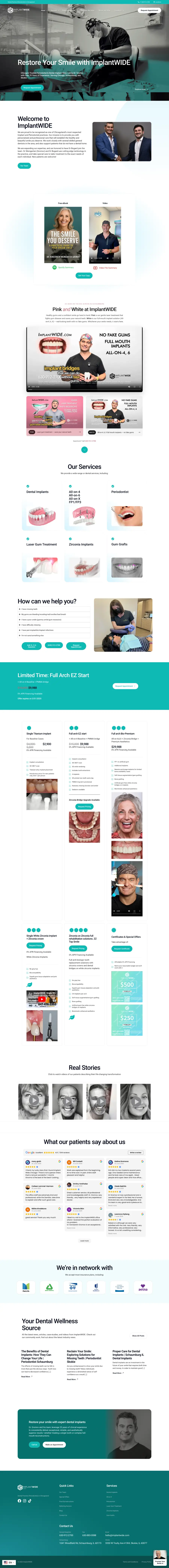 ImplantWide full homepage screenshot